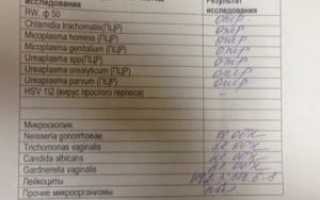 Анализ крови на инфекции у детей