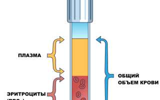 Гиперволемия МКК — Причины, Симптомы и Лечение