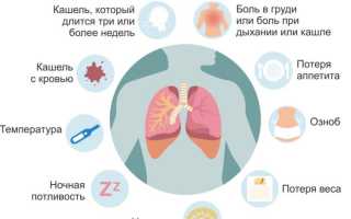 Локализованные инфильтраты — что это такое и как их распознать