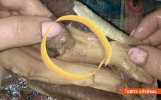 Описторхоз в селедке — миф или реальность?