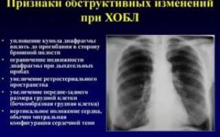 Симптомы заболевания легких и бронхов