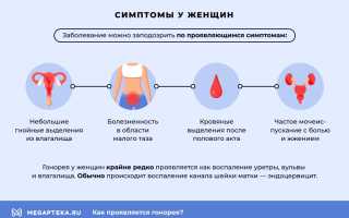 Гонорея у женщин — симптомы и эффективное лечение