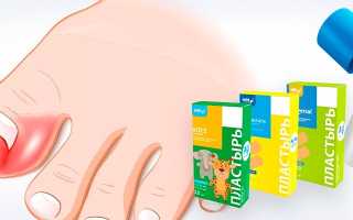 Устранение водяной мозоли — эффективные методы