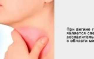Головная боль при ангине