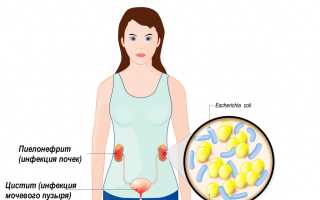 Моча мутная с белыми хлопьями у женщин