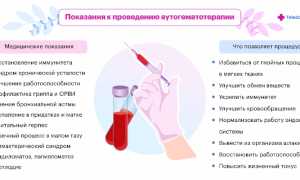 Аутогемотерапия — Пошаговый Процесс Лечения