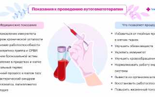 Аутогемотерапия — Пошаговый Процесс Лечения