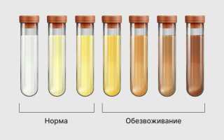 Моча у ребенка с осадком