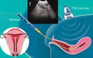 Отзывы о УЗИ маточных труб — опыт пациентов
