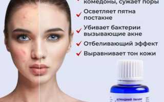Салициловый пилинг в домашних условиях — покупной или домашний
