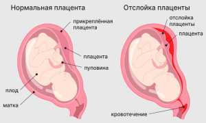 32 Недели Беременности — Почему Тянет Живот?