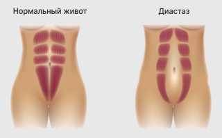 Тяга внизу живота на 21 неделе беременности — что это значит?