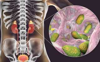 Продуло почки как лечить