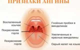 Можно ли мыться при ангине без температуры