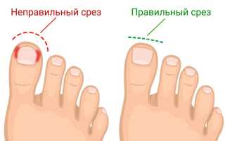Как ухаживать за ногами