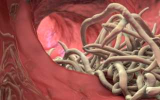 Аскарида — опасный паразит человека