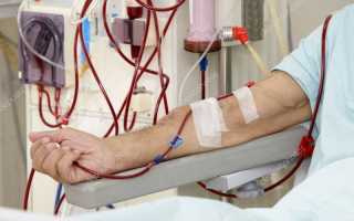 Что такое гемодиализ почек продолжительность жизни