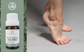 Эффективные народные средства от грибка ногтей на ногах