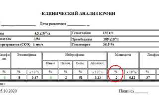 Повышение уровня моноцитов в крови — основные способы
