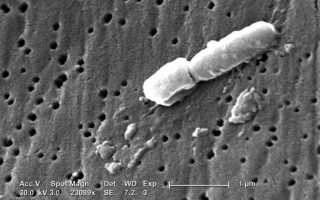 Klebsiella ozaenae — бактерия, вызывающая озаену
