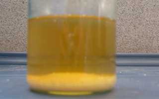 Моча при беременности с осадком