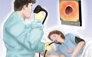 Промывание желудка — больно или нет?