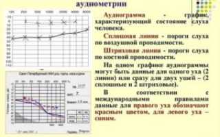 Расшифровка аудиограммы слуха