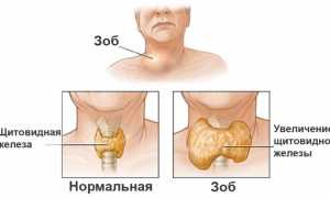 Мужской эутиреоз — причины, симптомы и лечение