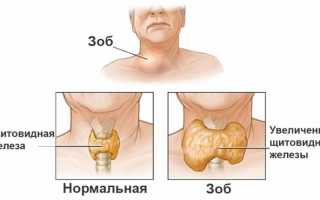 Мужской эутиреоз — причины, симптомы и лечение