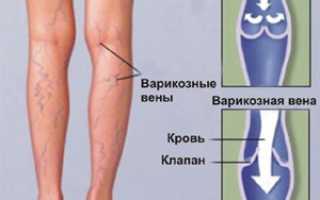 Внезапная боль в ноге — причины и действия