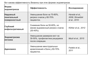 Визанна при эндометриозе — опыт реальных пациенток
