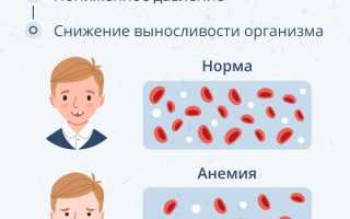 Признаки анемии у грудничка в 2 месяца