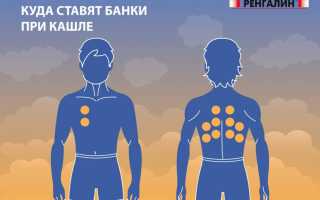 Можно ли при бронхите ставить банки