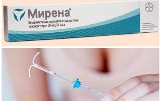 Лечебная спираль при эндометриозе — цены и отзывы пациенток