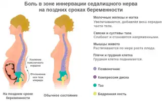 Спина болит на 22 неделе беременности — причины и способы облегчения