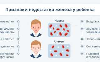 Анемия у новорожденных — основные симптомы и признаки