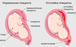 Боли внизу живота в третьем триместре беременности на 37 неделе