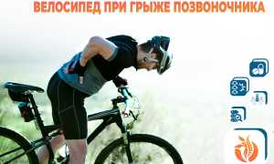 Велосипед при грыже поясницы — можно ли ездить?