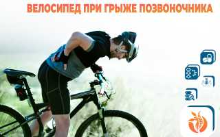 Велосипед при грыже поясницы — можно ли ездить?