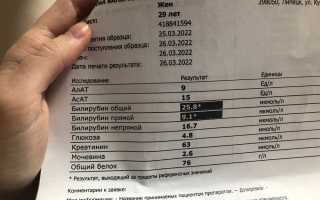 Повышенный билирубин при беременности — причины и последствия