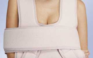 Повязка для перелома ключицы — выбор и применение