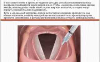 Операция по смене голоса