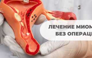 Лечение миомы матки в Боровой — эффективные методы