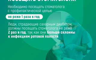 Как часто посещать стоматолога: забота о здоровье полости рта
