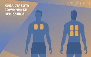 Бронхит и горчичники — можно ли использовать?