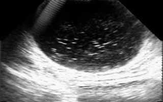 Мелкодисперсная взвесь