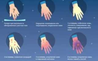 Переохлаждение ног последствия для мужчин