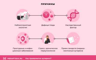 Эффективное лечение эутиреоза щитовидной железы у женщин