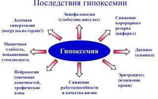 Гипоксемия и гиперкапния — причины, симптомы и лечение