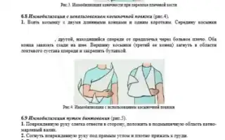 Иммобилизация перелома плеча — методы и рекомендации